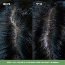 Zion Health Anti-Dandruff Shampoo 12oz image